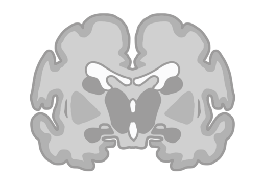 Hjernen illustreret ved koronalsnit